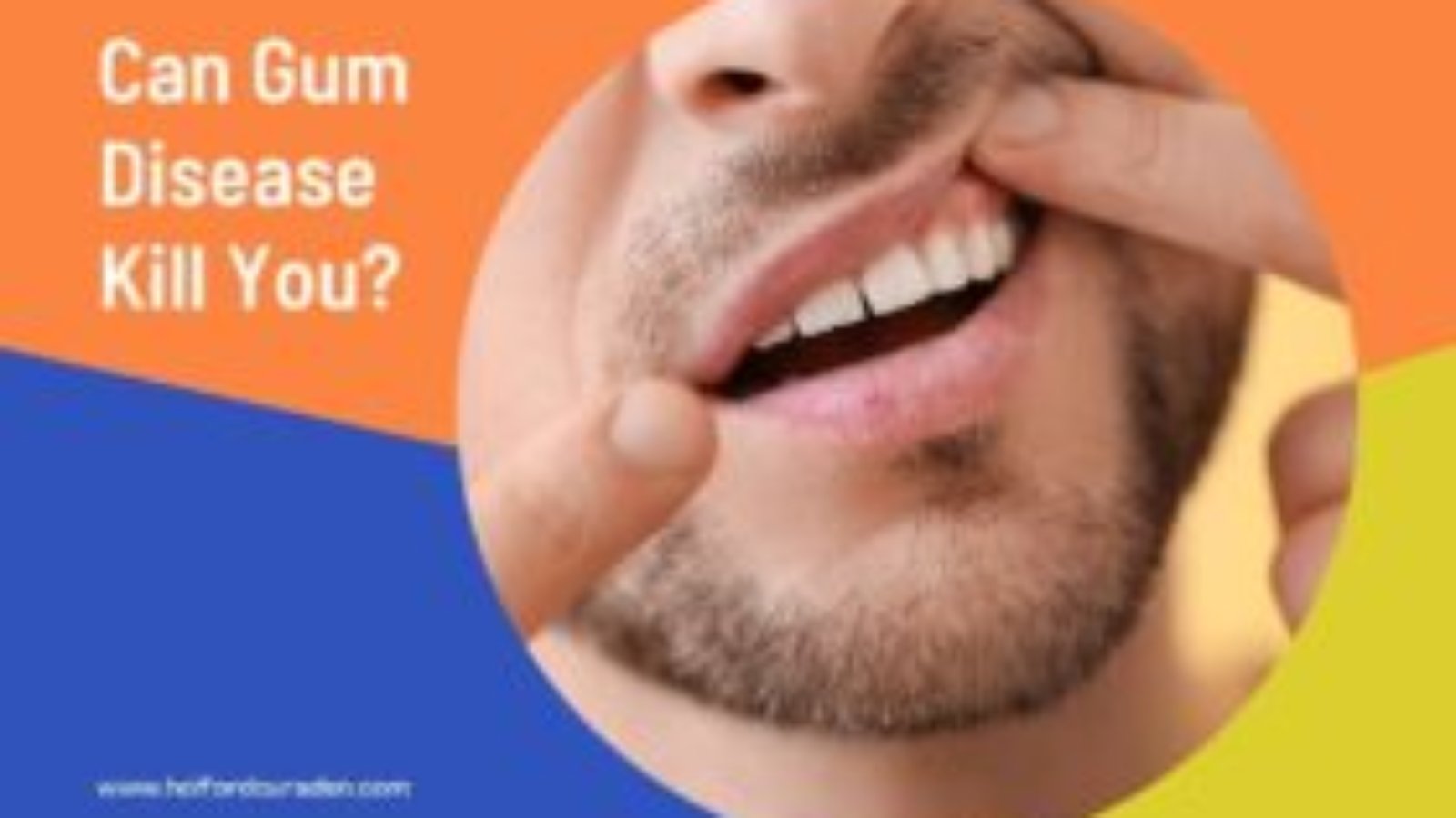 Can-Gum-Disease-Kill-You-280x180.jpg